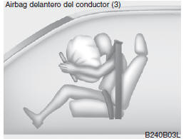 Componentes y funciones del SRS